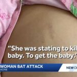 Pregnant woman attacked with bat while leaving work in